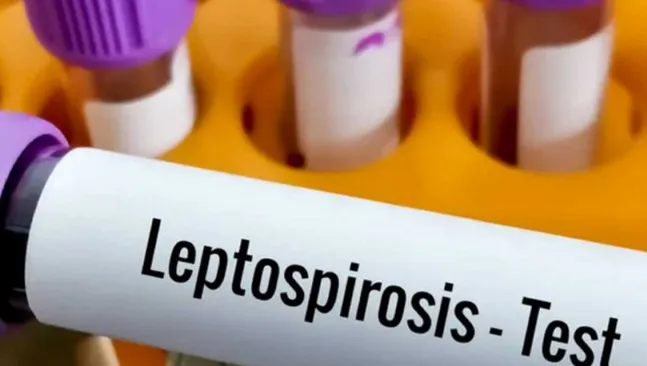 Córdoba: un hombre murió por leptospirosis en Bell Ville