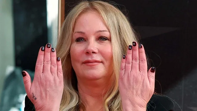 Esclerosis múltiple: qué es y cómo afecta la enfermedad que padece Christina Applegate