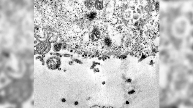 Captan imágenes del momento en que el Covid-19 infecta a una célula sana