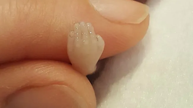 Posteó fotos de su hijo muerto a las 14 semanas para concientizar sobre el aborto